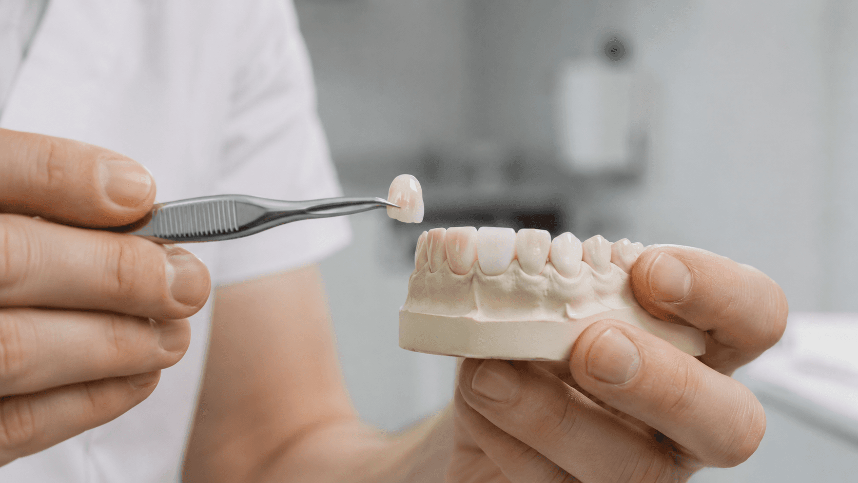 Licówka porcelanowa porównywana z modelem zęba podczas kwalifikacji do zabiegu w EBM Dentysta Poznań Piątkowo ul. Mateckiego 19