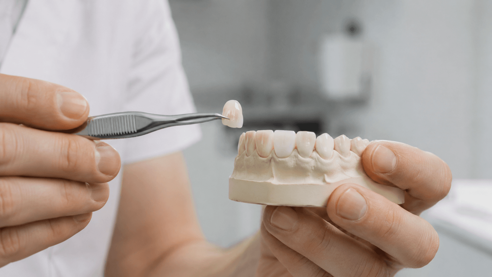 Licówka porcelanowa porównywana z modelem zęba podczas kwalifikacji do zabiegu w EBM Dentysta Poznań Piątkowo ul. Mateckiego 19