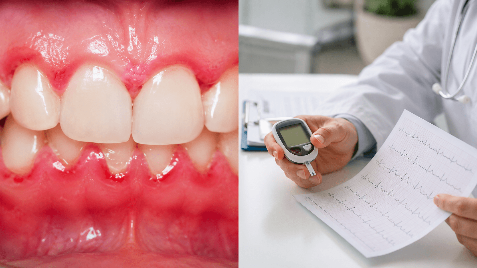 Związek paradontozy z cukrzycą i chorobami serca - diagnostyka przyzębia w EBM Dentysta Poznań Piątkowo ul. Mateckiego 19