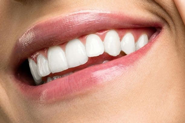 wybielanie zębów u dentysty
