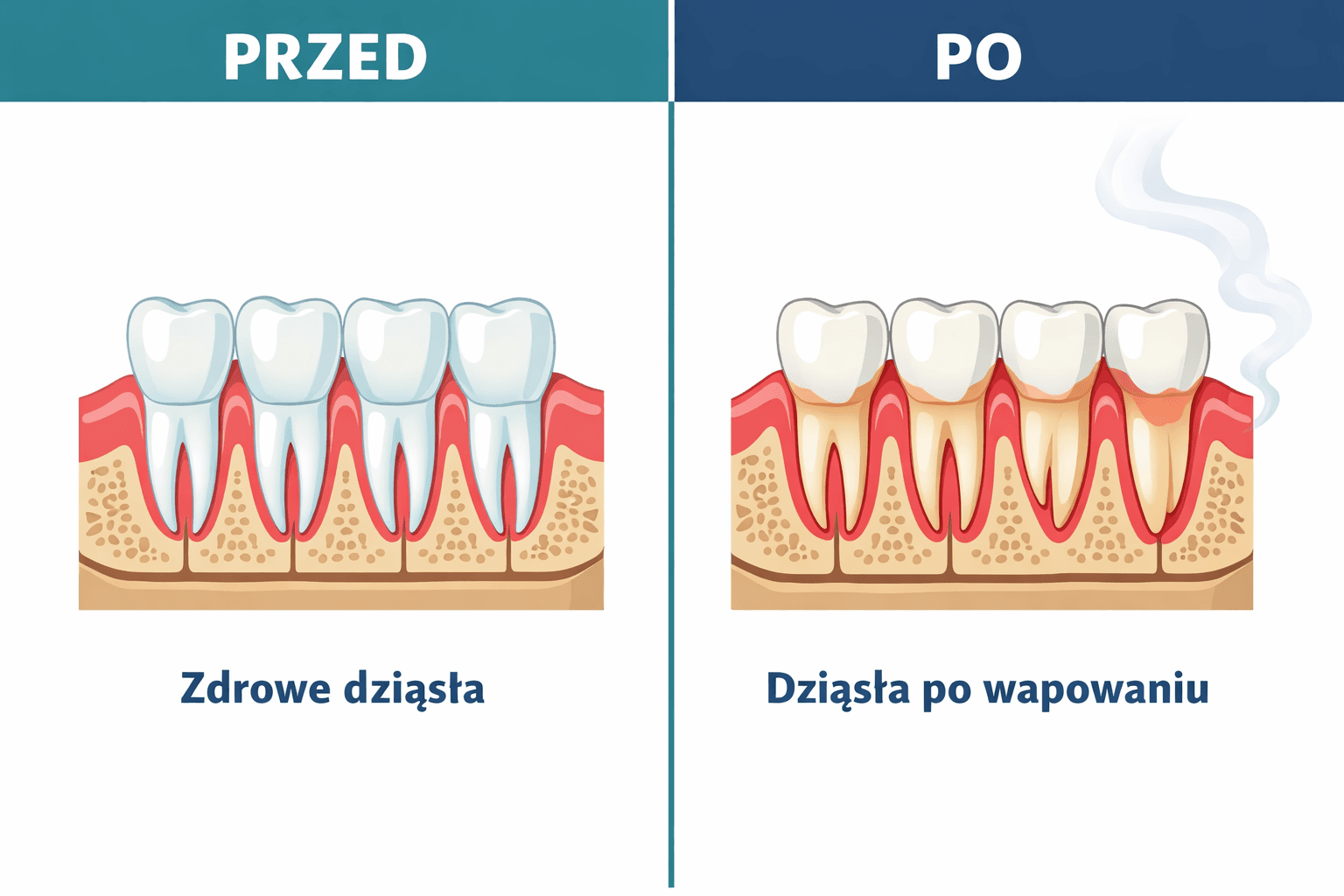 porównanie dziąseł